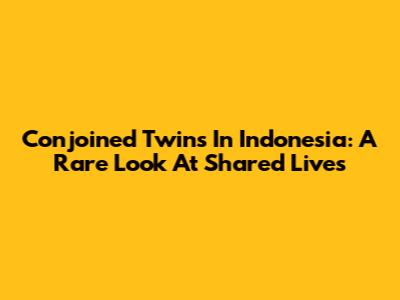 Conjoined Twins In Indonesia: A Rare Look At Shared Lives