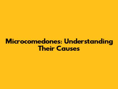 Microcomedones: Understanding Their Causes